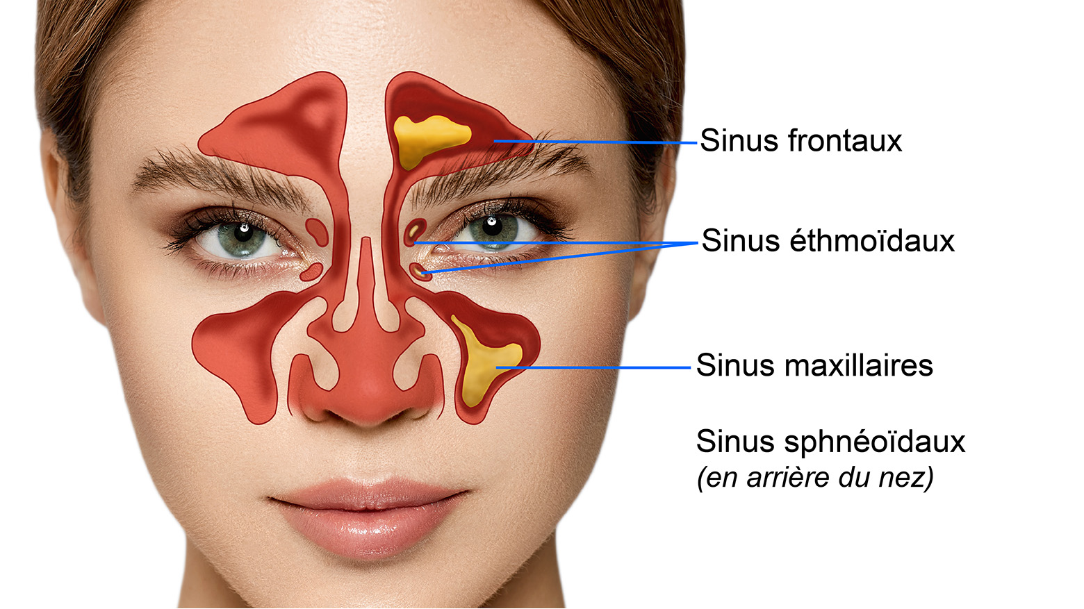 Nos Trois Nez Evo Evo Pour Comprendre Les Sinusites Chroniques nos-trois-nez-evo-evo-pour-comprendre-les-sinusites-chroniques