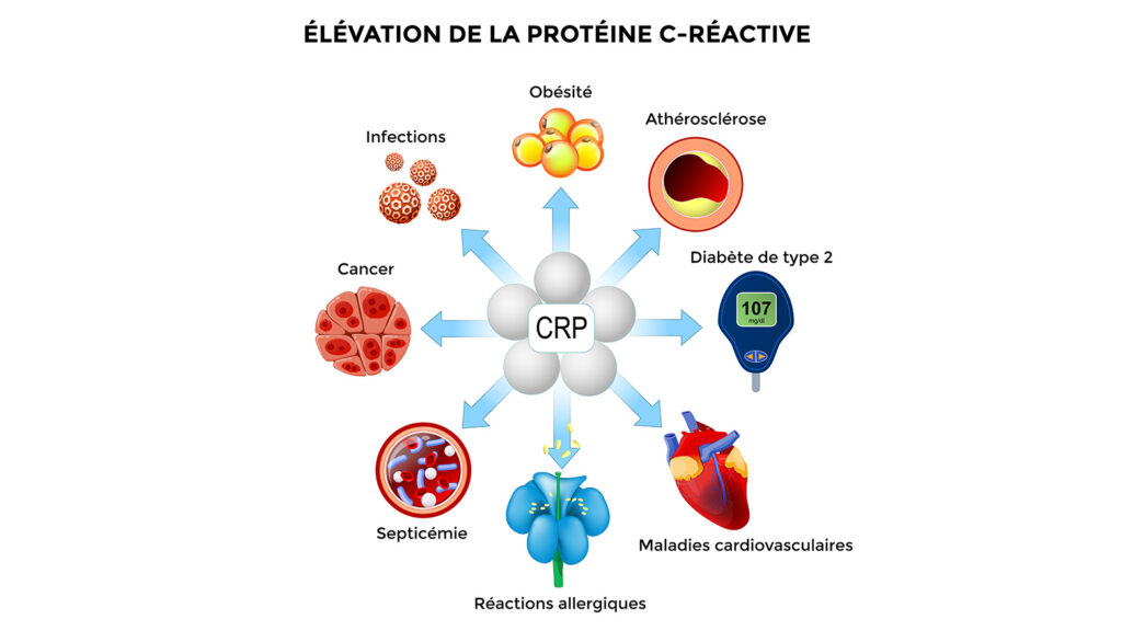 Diagramme des causes de l'élévation de la protéine C-Réactive.