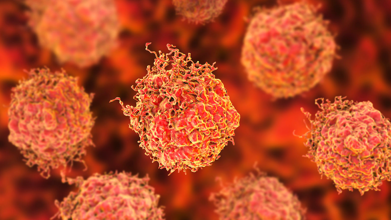 PSE : un nouveau test sanguin pour le cancer de la prostate
