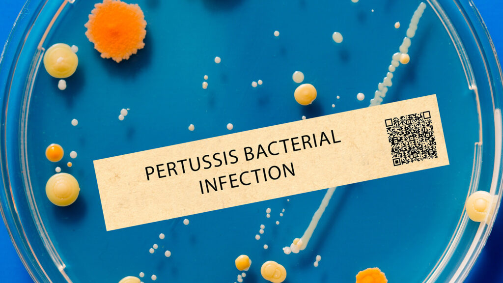 Boîte de Pétri avec des colonies de Bordetella pertussis.