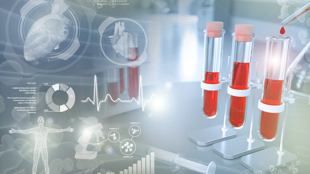 Image conceptuelle de tubes à essai contenant du sang avec des infographies médicales en arrière-plan.