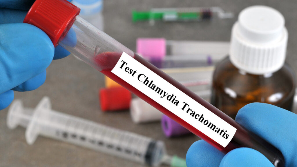 Test sanguin pour Chlamydia trachomatis