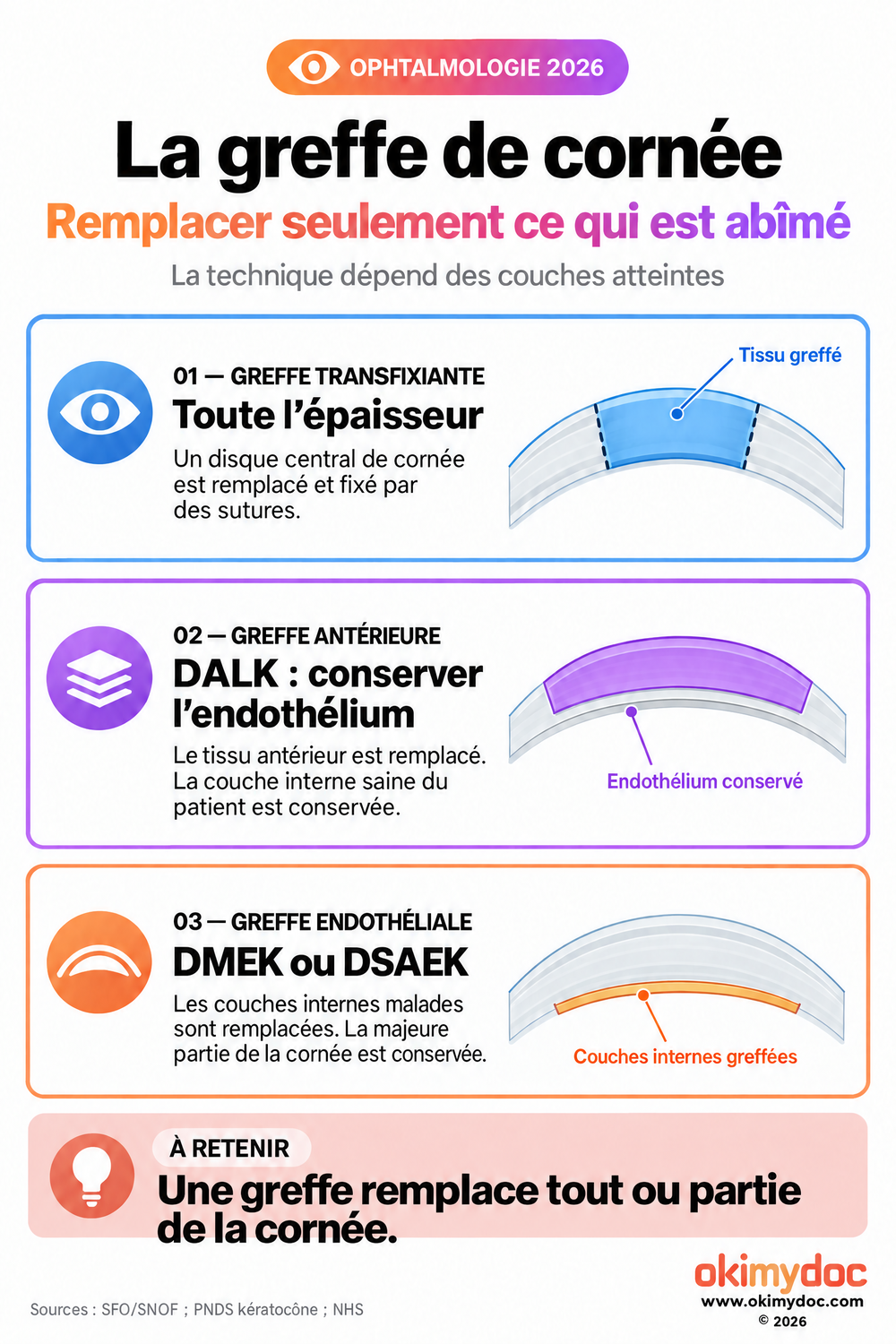 Infographie comparant la greffe transfixiante, la DALK et les greffes endothéliales selon les couches remplacées.