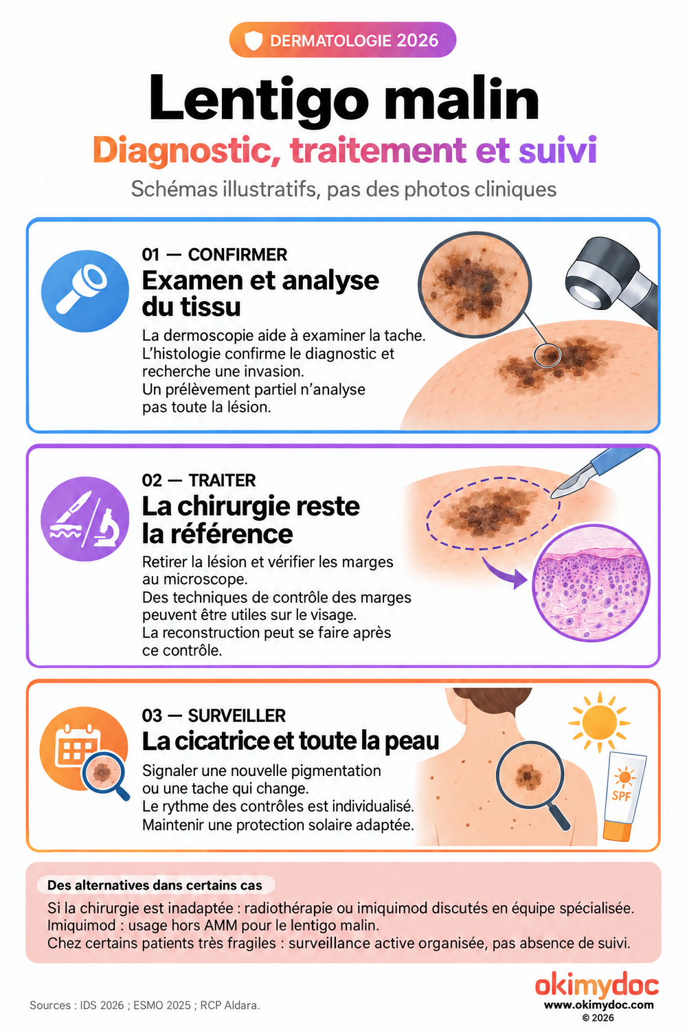 Étapes du diagnostic histologique, du traitement à marges contrôlées et de la surveillance du lentigo malin, avec alternatives dans certaines situations.
