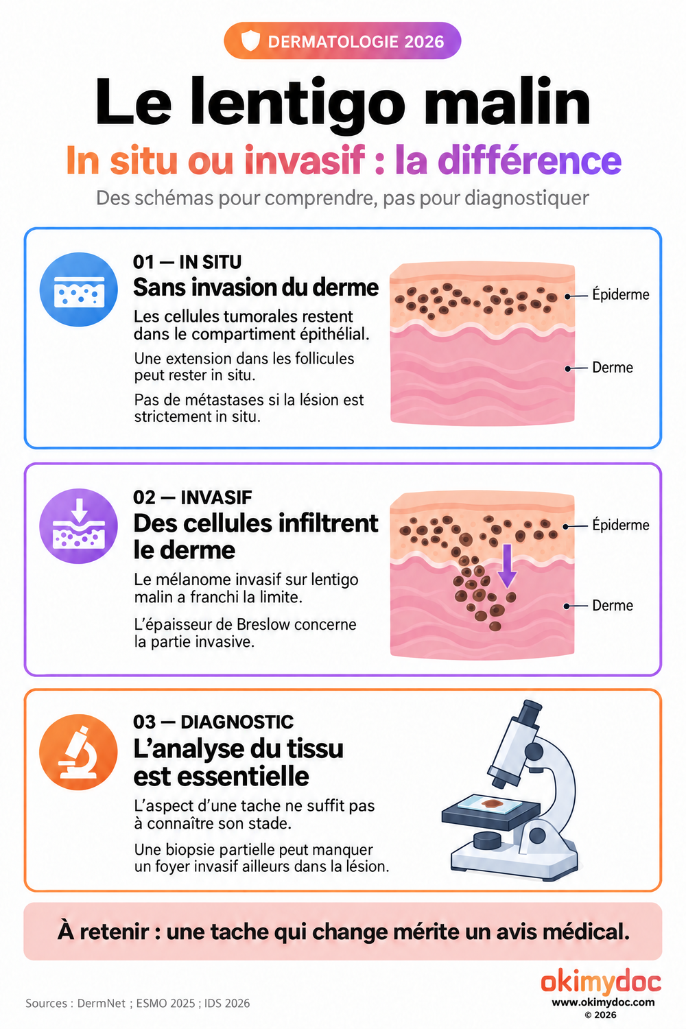 Schémas comparant les cellules d’un lentigo malin confinées au compartiment épithélial et celles d’un mélanome invasif infiltrant le derme.